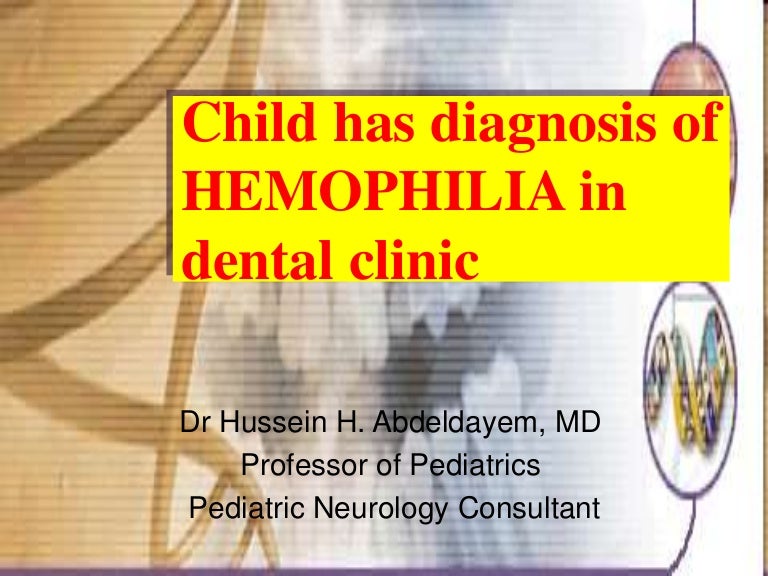Hemophilia in dental clinic