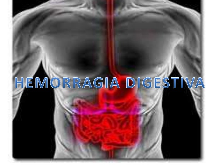 Hemorragia digestiva 1 Hemorragia digestiva 1