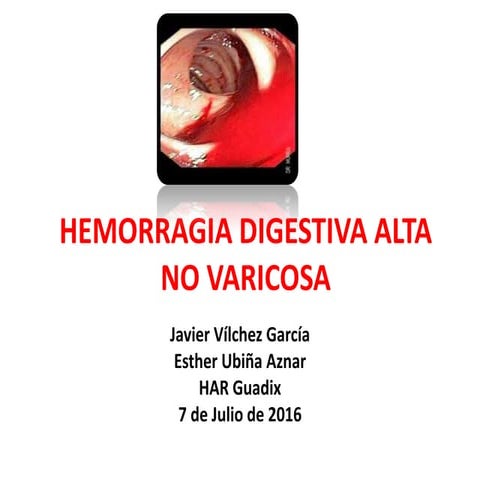 Hemorragia digestiva alta no varicosa