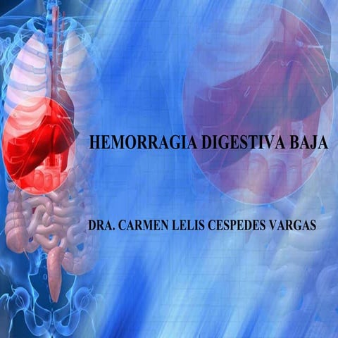 Hemorragia digestiva baja