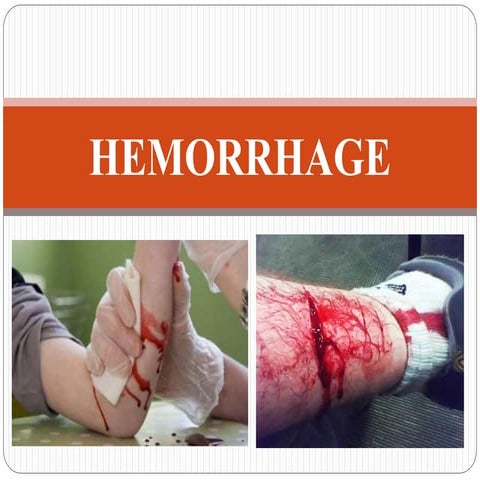 hemorrhage.pptx