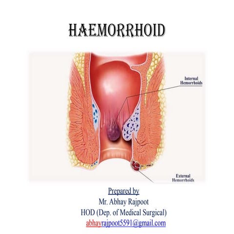 Hemorrhoids
