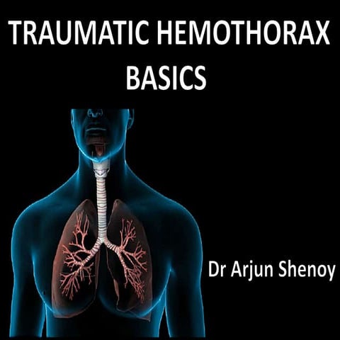 Traumatic Hemothorax and Intercostal Drainage