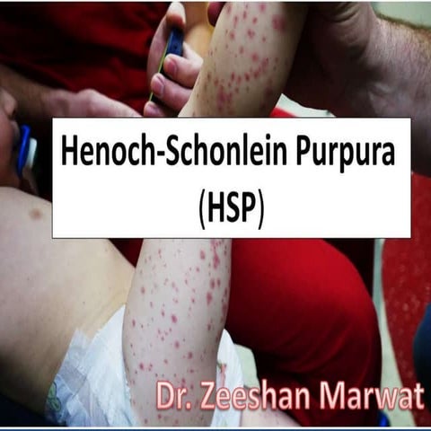 Henoch scholein purpura | PPTX