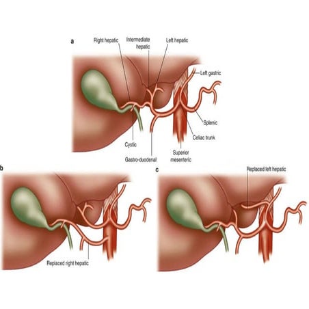 Hepatic artery varients