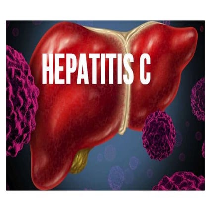Hepatitis c
