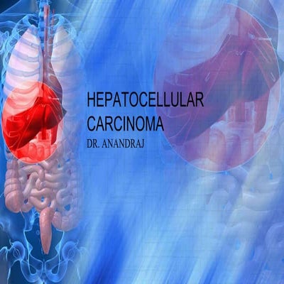 Hepatocellularcarcinoma  23-6-2016