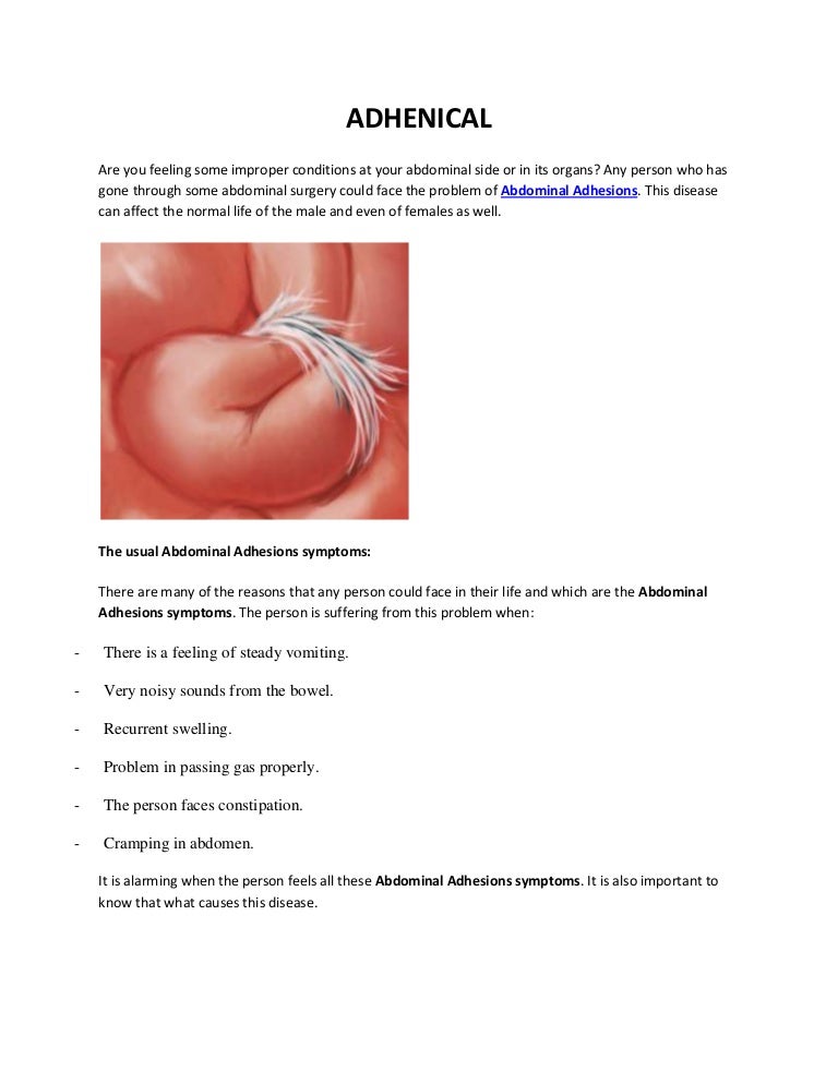 Abdominal Adhesions Treatment, Symptoms, Causes, Remedy