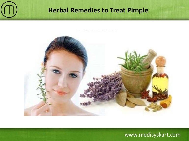 Herbal Remedies to Treat Pimple