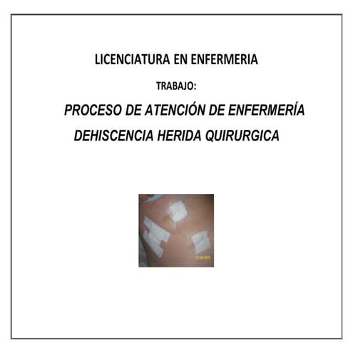 PROCESO DE ENFERMERÍA HERIDA QUIRURGICA