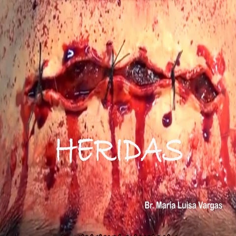 HERIDAS ,DEFINICION, CLASIFICACION Y MANEJO