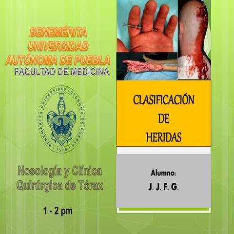 HERIDAS CLASIFICACIÓN DE HERIDAS Y SU MANEJO