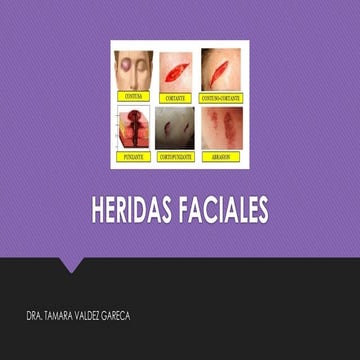 HERIDAS FACIALES en peritaje medico.pptx