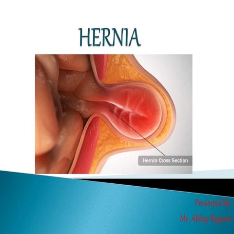 Hernia