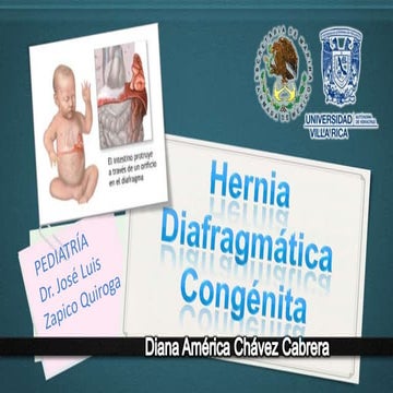 Hernia diafragmatica congénita