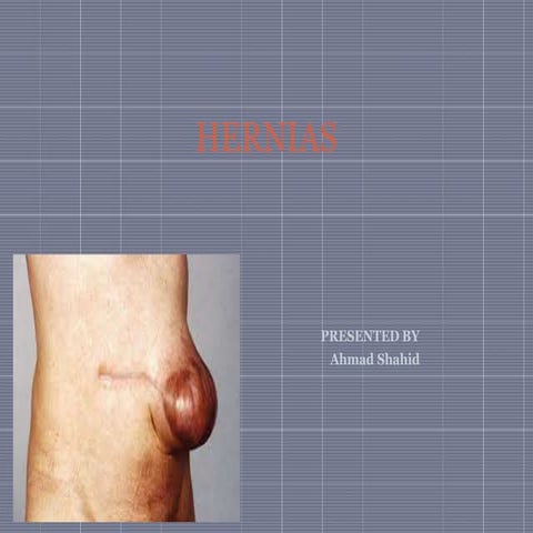 HERNIAS and its type and sign symptome treatment