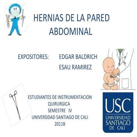 Hernias de la pared abdominal 