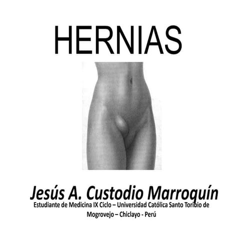 Hernias