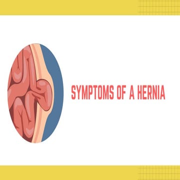 Common Signs and Symptoms Of Hernia