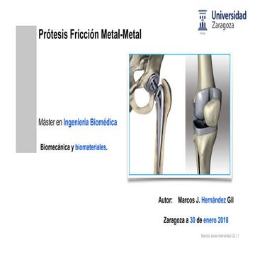Prótesis fricción Metal Metal | Marcos J. Hernández Gil 