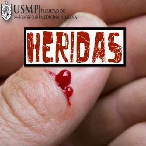 Heridas