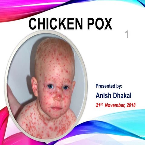 Chicken Pox (Varicella) & Herpes Zoster