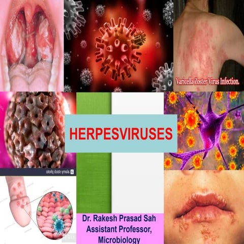 Herpes Virus and Varicella