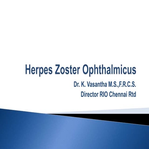 Herpes zoster