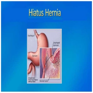 Hiatal hernia