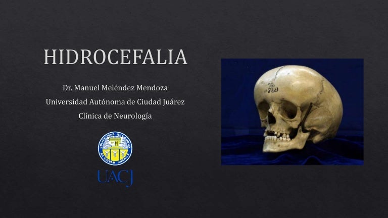 Hidrocefalia externa benigna en adultos