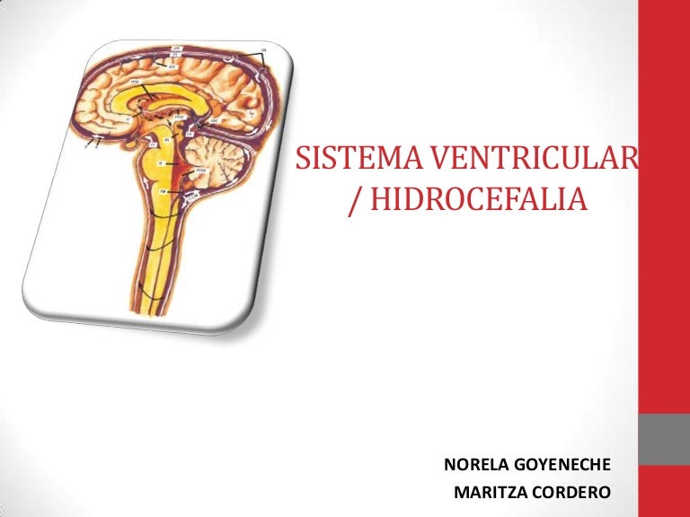 Dos derivaciones para hidrocefalia Dos derivaciones para hidrocefalia