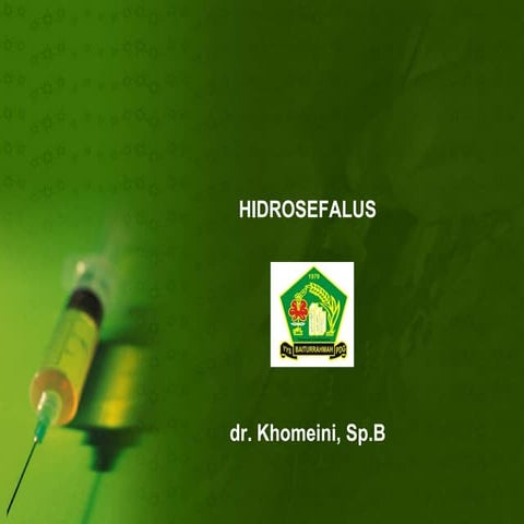 Hidrosefalus
