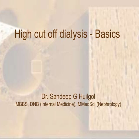 High cut off dialysis and multiple myeloma
