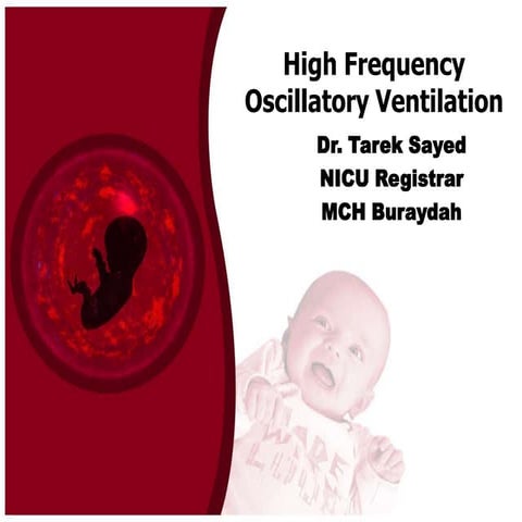 High frequency oscillatory ventilation