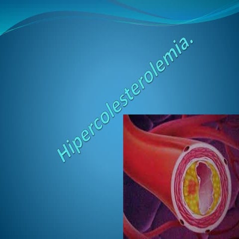 Hipercolesterolemia