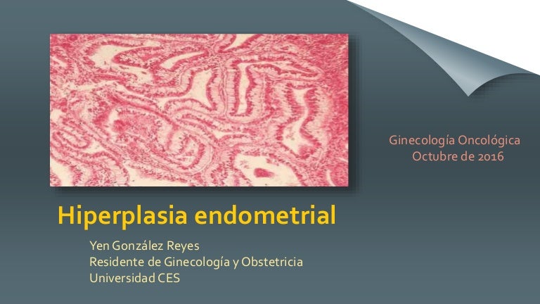 hiperplasia endometrial compleja con atipia sintomas hiperplasia endometrial compleja con atipia sintomas