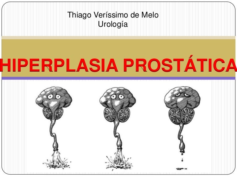 sfaturi pentru stilul de viață pentru prostatită