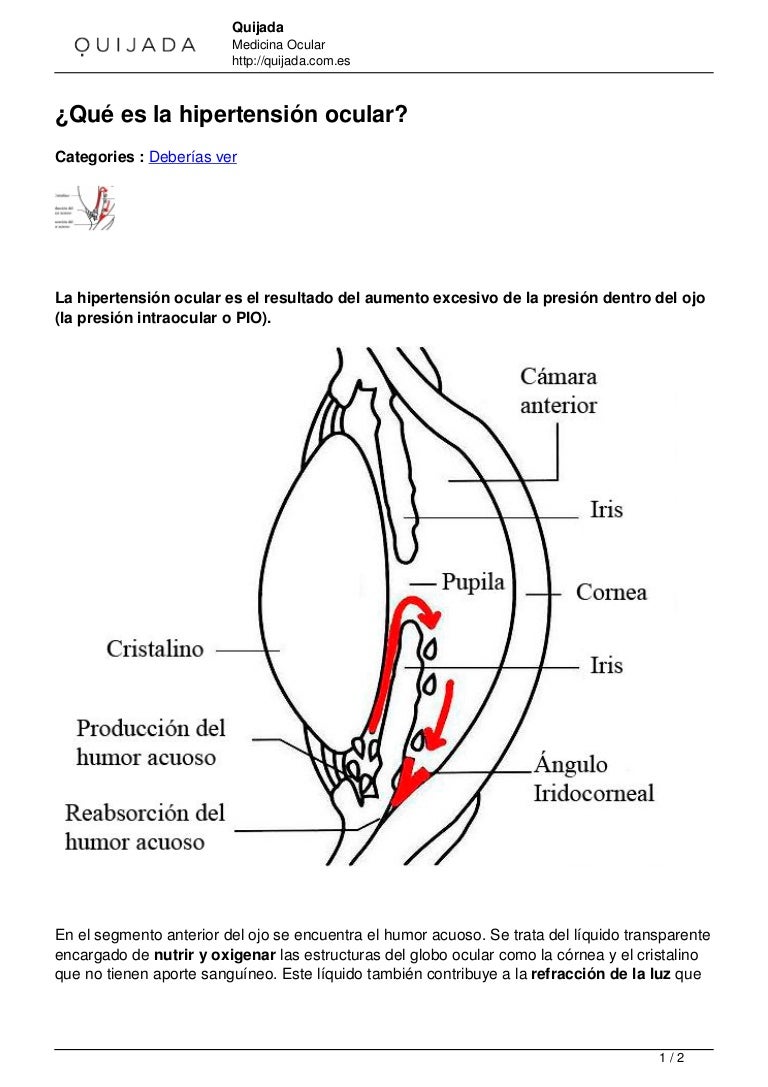 Definir medicamentos para la hipertensión ocular