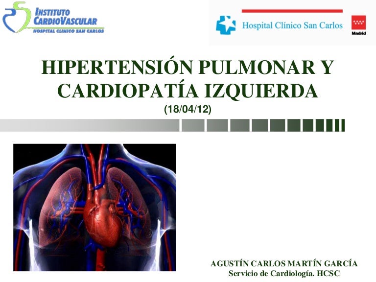 Clasificación clínica reciente de hipertensión pulmonar