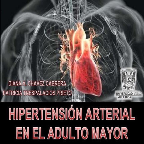 Hipertension arterial del adulto mayor