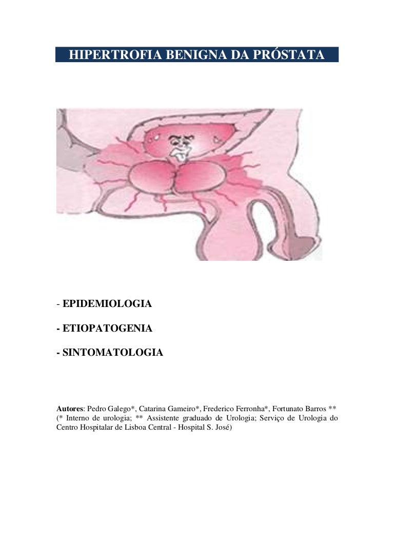 cálculos en la próstata y vejiga rica y