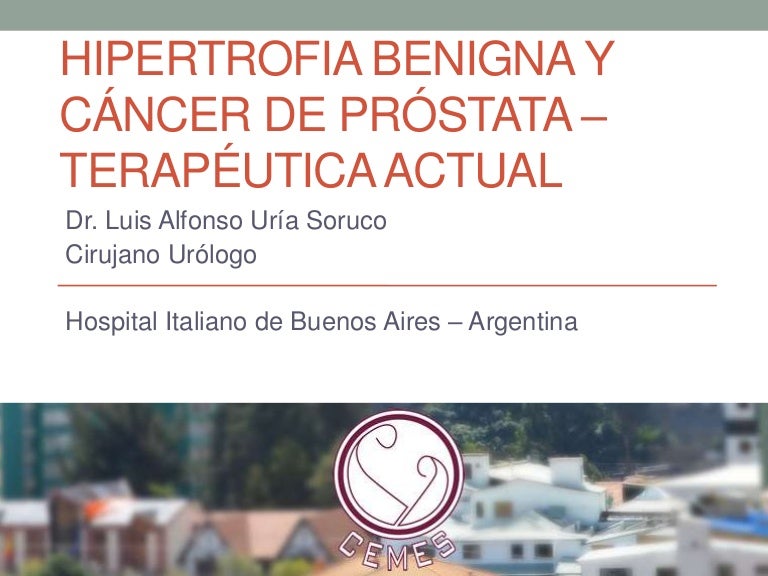 tratamiento del cáncer de próstata gleason 7 n1