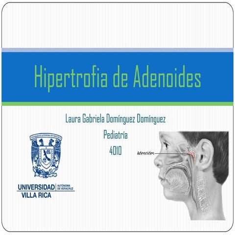 Hipertrofia de adenoides