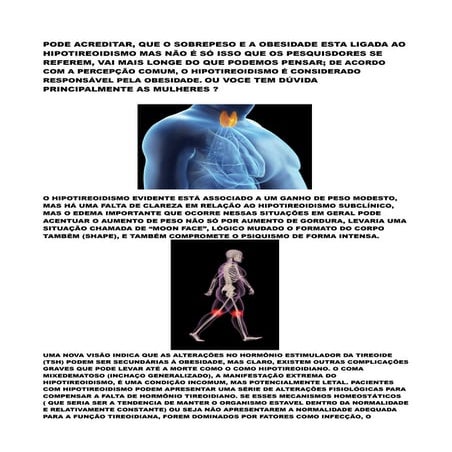 PODE ACREDITAR, QUE O SOBREPESO E A OBESIDADE ESTA LIGADA AO HIPOTIREOIDISMO