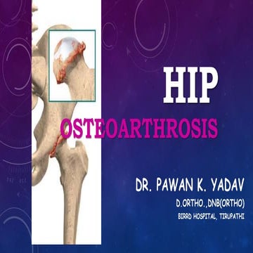 Hip Osteoarthrosis -PAWAN