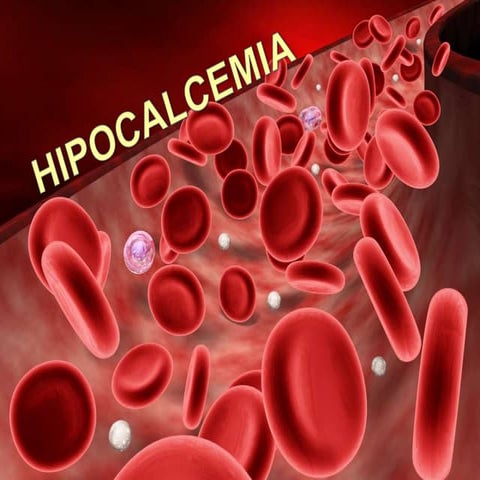 Hipocalcemia 