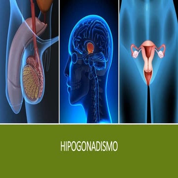 Hipogonadismo | PPTX
