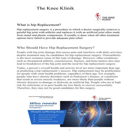 Total hip replacement – a patient guide | PPT