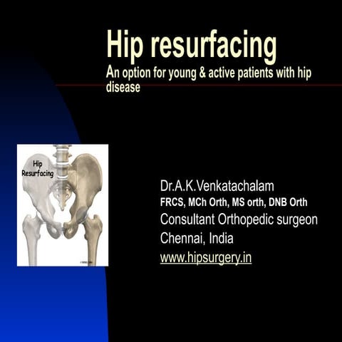 Hip resurfacing India | Dr.Venkatachalam 