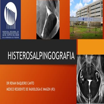 Histerosalpingografia